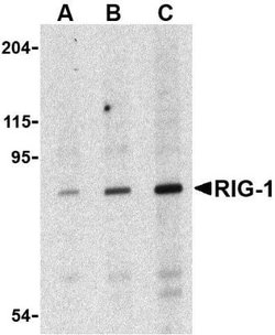 RIG-I Antibody, Novus Biologicals 0.1mg; Unlabeled:Antibodies, Polyclonal
