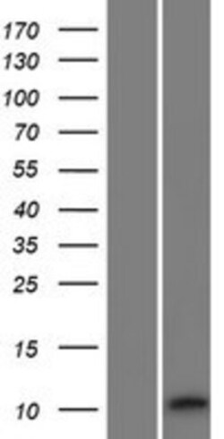 Novus Biologicals&trade;&nbsp;RIIAD1 Overexpression Lysate