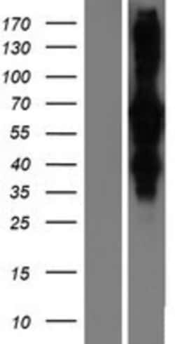 Novus Biologicals&trade;&nbsp;RILP Overexpression Lysate