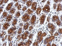 RILPL2 Antibody, Novus Biologicals 0.1mL; Unlabeled:Antibodies, Polyclonal