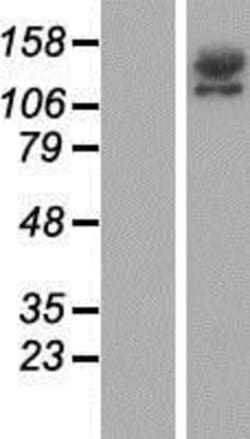 Novus Biologicals™ RIMS2 Overexpression Lysate