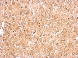 RIN2 Antibody, Novus Biologicals 0.1mL; Unlabeled:Antibodies, Polyclonal