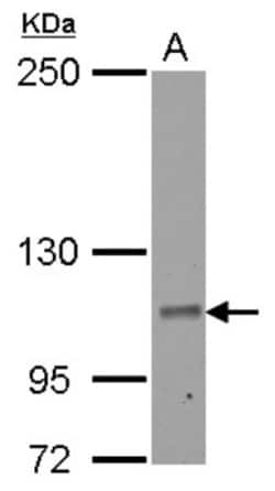 RIN2 Antibody, Novus Biologicals 0.1mL; Unlabeled:Antibodies, Polyclonal