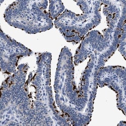RINT1 Antibody, Novus Biologicals 0.1mL; Unlabeled:Antibodies, Polyclonal