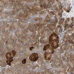 RIOK2 Antibody, Novus Biologicals:Antibodies:Primary Antibodies