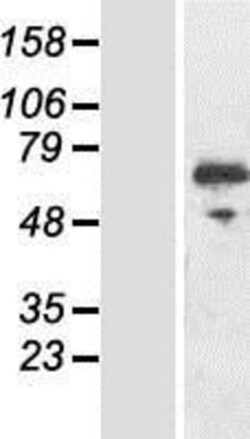 Novus Biologicals&trade;&nbsp;RIOK3 Overexpression Lysate
