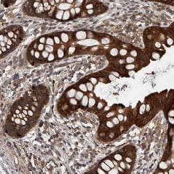LHX9 Antibody, Novus Biologicals:Antibodies:Primary Antibodies