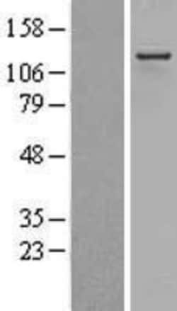 Novus Biologicals™ RIP140 Overexpression Lysate
