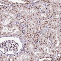 RIP140 Antibody, Novus Biologicals 25 &mu;L, Unlabeled:Antibodies, Polyclonal
