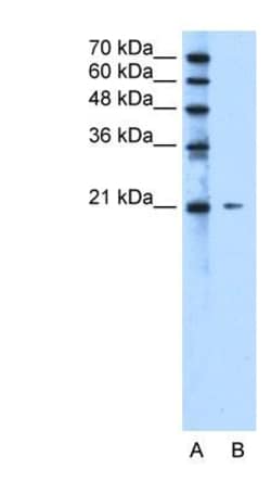 RIP5 Antibody, Novus Biologicals:Antibodies:Primary Antibodies