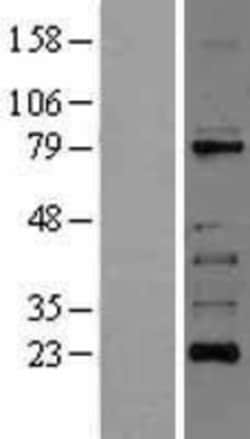 Novus Biologicals™ RIPK1/RIP1 Overexpression Lysate