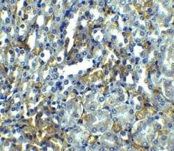 RIPK1/RIP1 Antibody - BSA Free, Novus Biologicals:Antibodies:Primary Antibodies