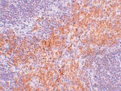 RIPK1/RIP1 Antibody - BSA Free, Novus Biologicals:Antibodies:Primary Antibodies