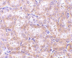 RIPK3/RIP3 Antibody - BSA Free, Novus Biologicals 0.1mg; Unlabeled:Antibodies,