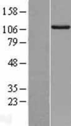 Novus Biologicals&trade;&nbsp;RIPK5 Overexpression Lysate