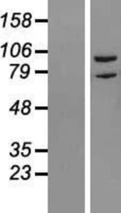 Novus Biologicals&trade;&nbsp;RIPK5 Overexpression Lysate