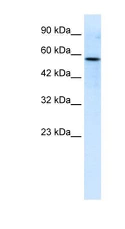 RIPX Antibody, Novus Biologicals&trade;