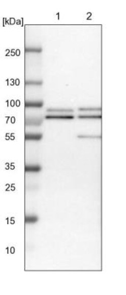 RIPX Antibody, Novus Biologicals 0.1mL; Unlabeled:Antibodies, Polyclonal