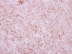 Rit1 Antibody, Novus Biologicals 0.1mL; Unlabeled:Antibodies, Polyclonal