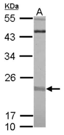 Rit1 Antibody, Novus Biologicals 0.1mL; Unlabeled:Antibodies, Polyclonal