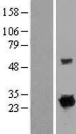Novus Biologicals&trade;&nbsp;Rit1 Overexpression Lysate