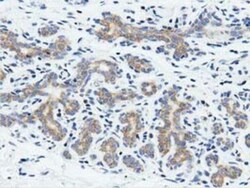 Rit2 Antibody (OTI3F4), Novus Biologicals 0.1mL; Unlabeled:Antibodies,