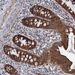RITA Antibody, Novus Biologicals:Antibodies:Primary Antibodies