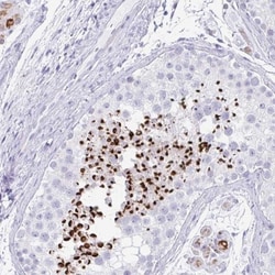 RLF Antibody, Novus Biologicals:Antibodies:Primary Antibodies