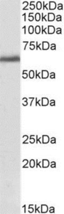 RLK/TXK Antibody, Novus Biologicals 0.1 mg | Buy Online | Novus Biologicals | Fisher Scientific