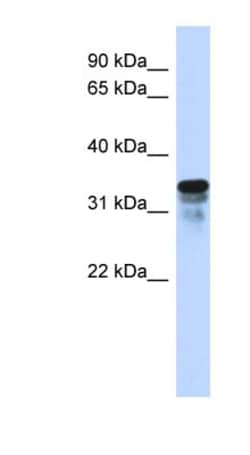 RMD1 Antibody, Novus Biologicals 100&mu;L; Unlabeled:Antibodies, Polyclonal