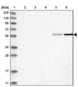 RMND1 Antibody, Novus Biologicals 25 &mu;L | Buy Online | Novus Biologicals | Fisher Scientific