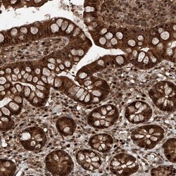 RMND1 Antibody, Novus Biologicals 25 &mu;L | Buy Online | Novus Biologicals | Fisher Scientific