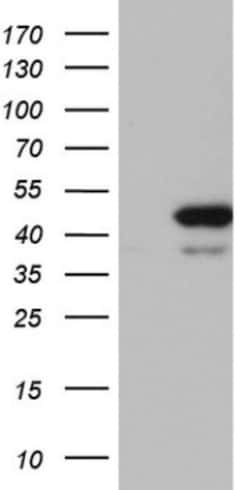 RMND5A Antibody (OTI2C8), Novus Biologicals 0.1mL; Unlabeled:Antibodies,