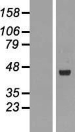Novus Biologicals&trade;&nbsp;RMND5B Overexpression Lysate