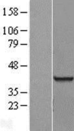 Novus Biologicals™ RNA binding motif protein, X-linked 2 Overexpression Lysate