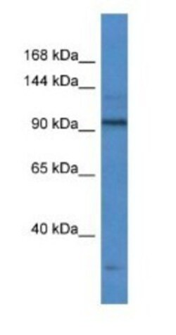 RNA polymerase I termination factor Antibody, Novus Biologicals 100&mu;L;