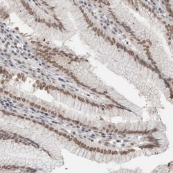 RNA binding motif protein, X-linked 2 Antibody, Novus Biologicals 0.1mL;