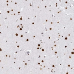 RNA Helicase A Antibody, Novus Biologicals 0.1mL; Unlabeled:Antikörper