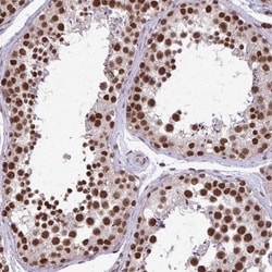 RNA polymerase I termination factor Antibody, Novus Biologicals 0.1mL;
