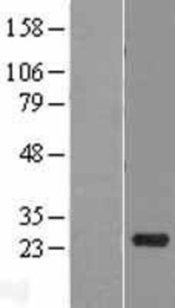 Novus Biologicals&trade;&nbsp;RNASE10 Overexpression Lysate