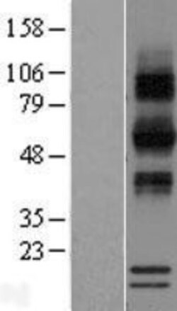 Novus Biologicals&trade;&nbsp;RNASE12 Overexpression Lysate