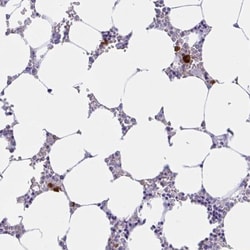 RNASE3 Antibody, Novus Biologicals 25 &mu;L, Unlabeled:Antibodies, Polyclonal
