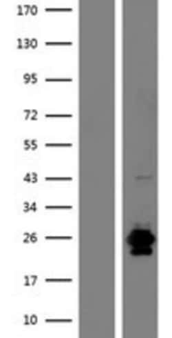 Novus Biologicals&trade;&nbsp;RNASE9 Overexpression Lysate