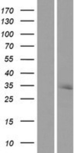Novus Biologicals&trade;&nbsp;RNASEH2A Overexpression Lysate