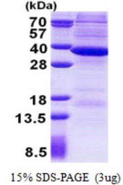 Novus Biologicals&trade;&nbsp;Recombinant Human RNASEH2A His Protein
