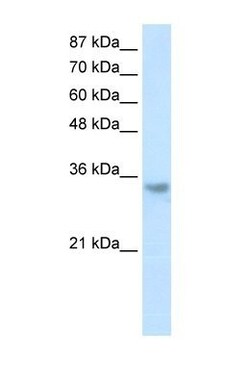 RNASEH2A Antibody, Novus Biologicals 20&mu;L; Unlabeled:Antibodies, Polyclonal