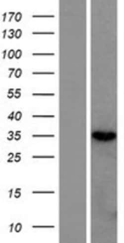 Novus Biologicals&trade;&nbsp;RNASEH2B Overexpression Lysate