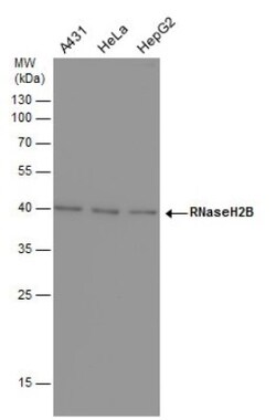 RNASEH2B Antibody (419), Novus Biologicals 0.1mL; Unlabeled:Antibodies,