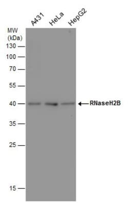 RNASEH2B Antibody (479), Novus Biologicals 0.1mL; Unlabeled:Antikroppar