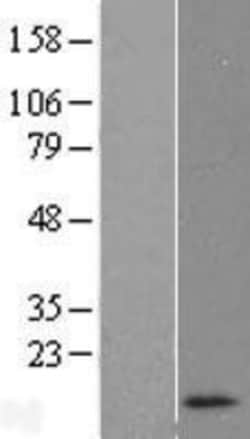 Novus Biologicals™ RNASEK Overexpression Lysate